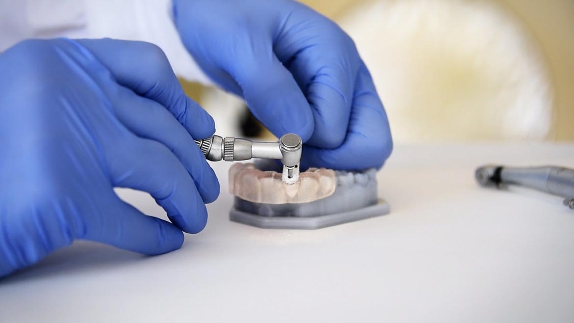 Implantes Sin Cirugía