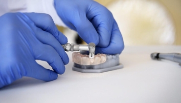 Implantes Sin Cirugía